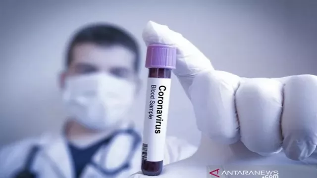Kamerun Sukses Meredam Penyebaran Virus Corona - GenPI.co