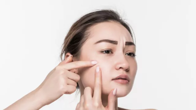 Perawatan Ini Ampuh Menghilangkan Dark Spot Di Wajah, Cobain Yuk! - GenPI.co