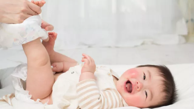 4 Tips Merawat Kulit Bayi yang Terkena Ruam Popok - GenPI.co