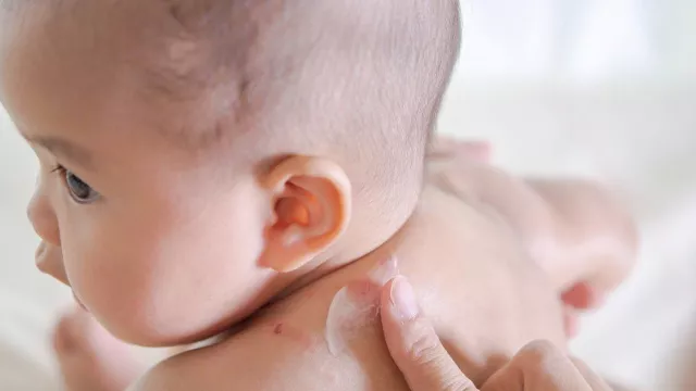 Ibu, 4 Cara Ini Bisa Tangkal Gigitan Nyamuk yang Mengganggu Bayi - GenPI.co
