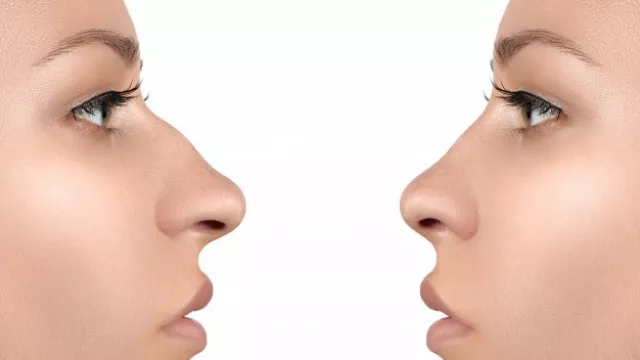 4 Cara Receh Bikin Hidung Mancung Alami Tanpa Oplas - GenPI.co