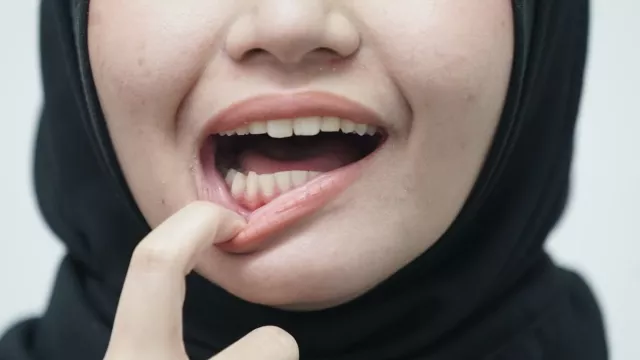 Ini Cara Jaga Kesehatan Gigi dan Mulut Selama Puasa - GenPI.co JATENG