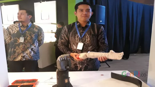 Teknologi Tangan Bionik Karya Anak Bangsa - GenPI.co