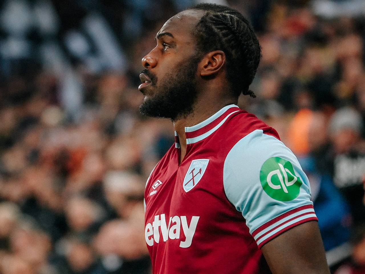 West Ham United Sebut Michail Antonio Alami Patah Kaki karena Kecelakaan