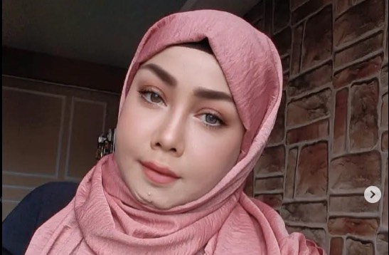 Wajah Bikin Minder, Rency Milano Habiskan Rp 800 Juta demi Operasi Plastik
