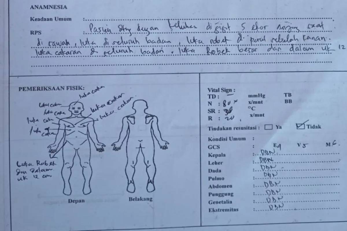 Anak 13 Tahun Digigit 5 Anjing Liar di Lombok, Alami Luka di Kaki hingga Badan