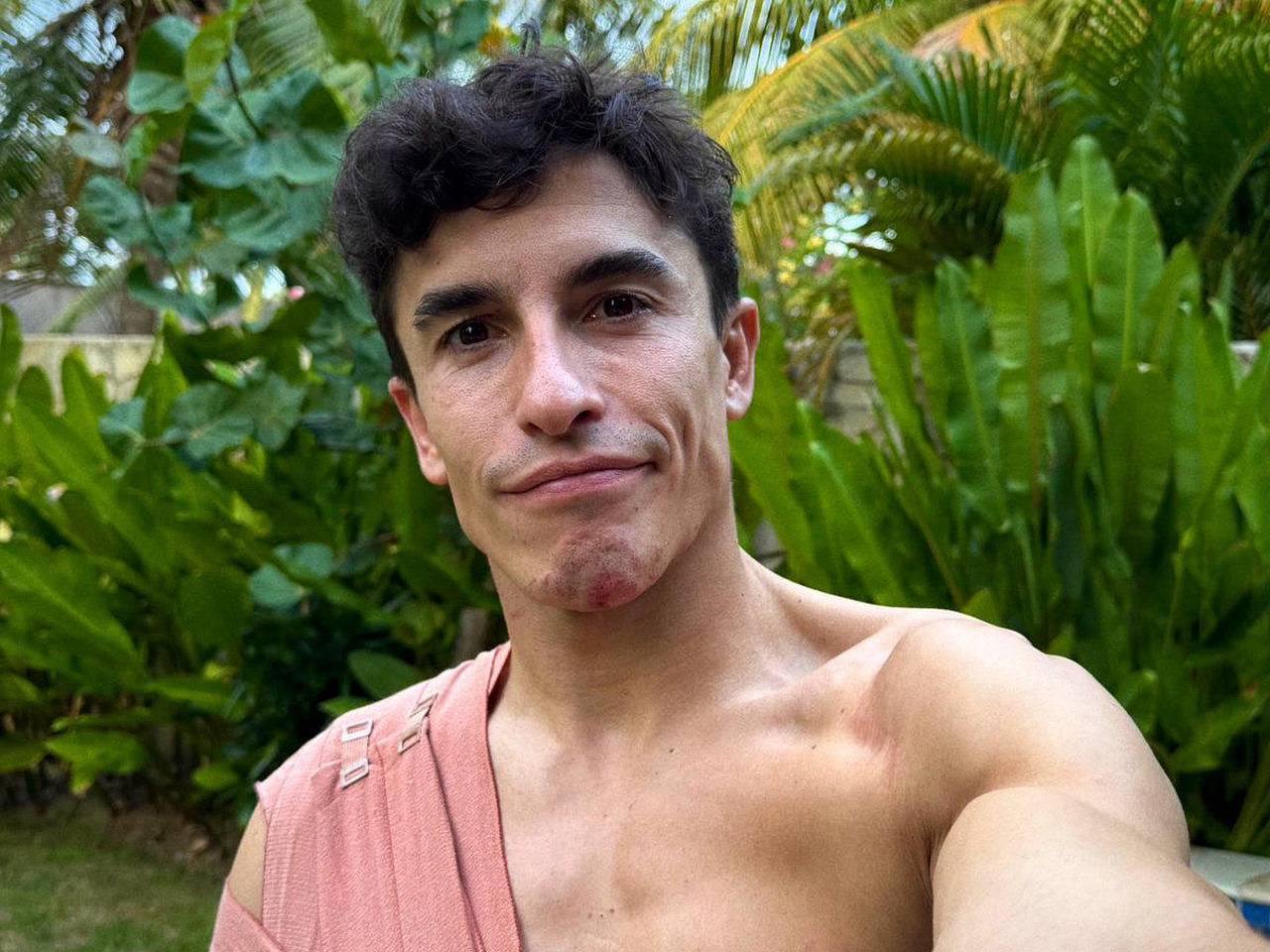 Cedera Bahu Kanan, Marc Marquez Absen di MotoGP Australia dan Malaysia