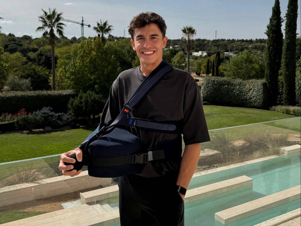 Selesai Jalani Operasi Bahu, Marc Marquez Mulai Membaik