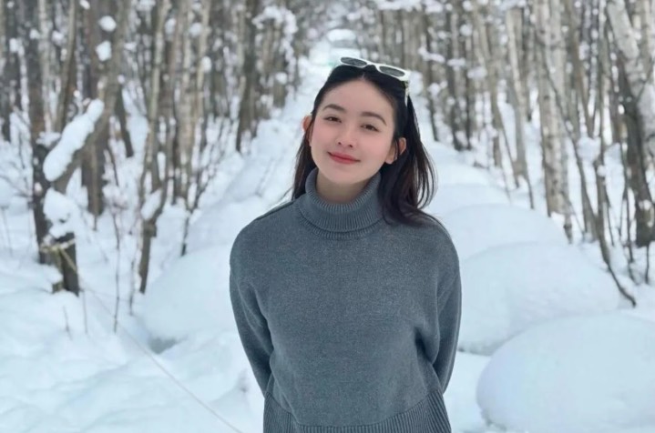 Wajah Jerawatan, Natasha Wilona Sempat Minder di Depan Kamera